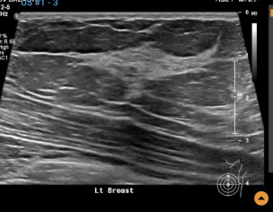 Inflammation? Cancer?