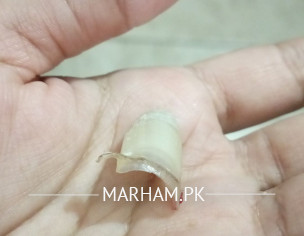 Toe Nail Ripped Off Completely