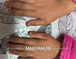 Rush On Hands And Face