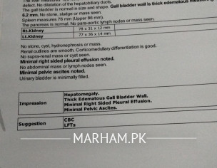 Hepatitis Ascites Inkid