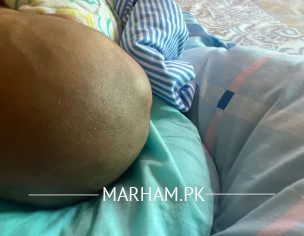 Bump On My Son Head (pediatricians)