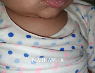 Baba Boy Excess Saliva