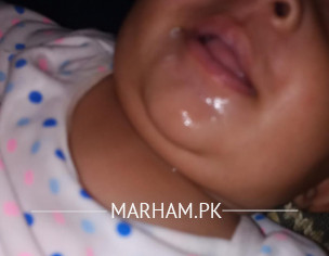 Baba Boy Excess Saliva