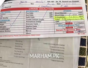 Arthritis (Joint Pains) 