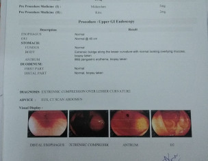 Stomach And Colon Issue