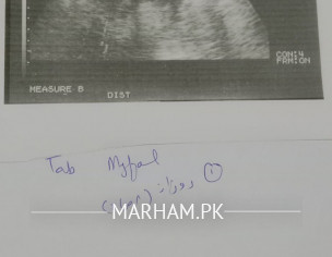 Beta Hcg Test Krwaya. Weeks Btayen