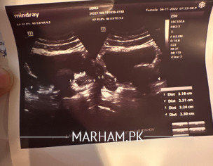 Follicles In Ovaries