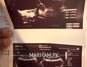 Follicles In Ovaries