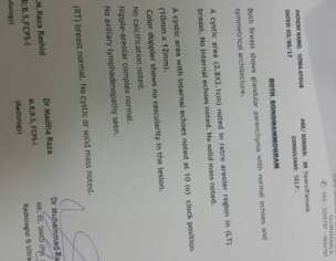 Asking About Reports