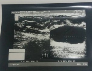 Asking About Reports