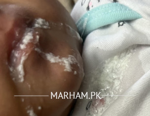 7 Weeks Old Baby Vomit N Spit