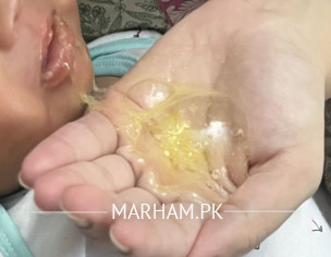 7 Weeks Old Baby Vomit N Spit