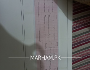 Is This Ecg Normal ?