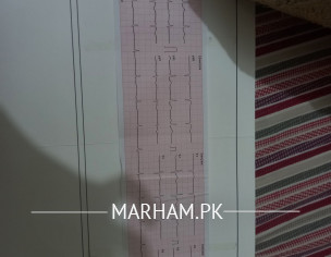 Is This Ecg Normal ?