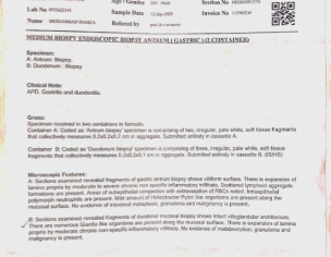 Bloating, Constipation