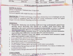 Bloating, Constipation