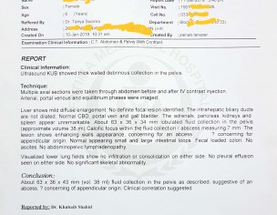 Appendicular Abscess 