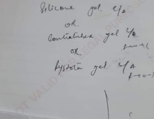 Sabaceous Cyst Removed