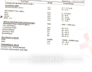 Right Knee Joint Pain