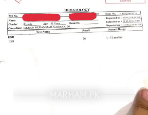 Right Knee Joint Pain