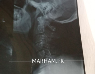 Neck Xray