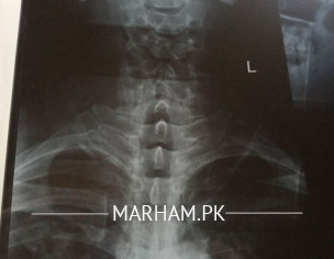 Neck Xray