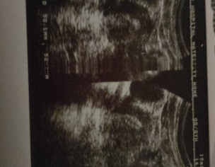 Pelvis Report Checking