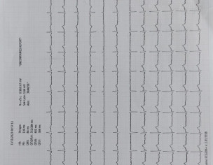 Right Chest Pain Like Chubna