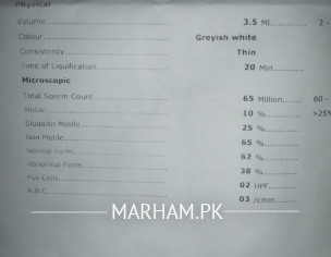 Seman Analysis