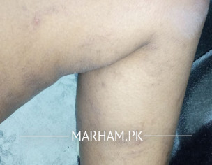 Lft Test Reporte Check