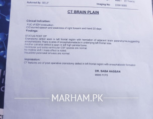 4 Month, Brain Stroke