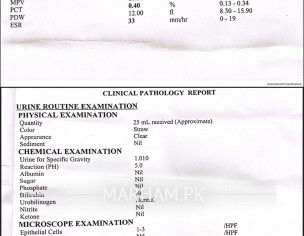 Dizziness And Ear Problem 