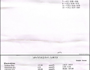 Dizziness And Ear Problem 