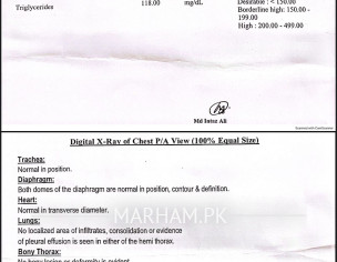 Dizziness And Ear Problem 