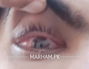 Ashob- Chishm (pink Eye)