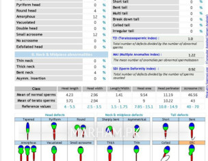 Semon Analysis Test Results