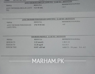 Hyperthyroidism/hypothyroidism