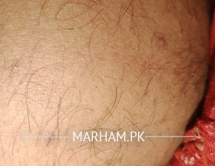 Skin Issue And Hair Problem