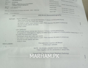 Gilti In Breast Left Side