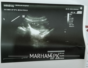 Weak Pregnency/slow Growth