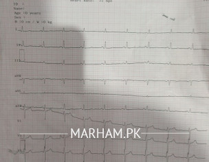 Check Ecg