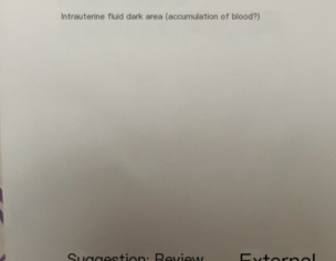 First Pregnancy Transvaginal Scan