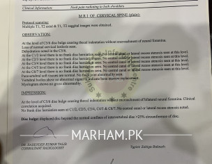 Nerve Pain (Nerve Weakness)