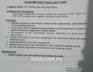 Sub Acromial Bursitis