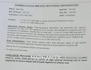 LINAR Laboratory Test