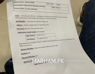 Jaundice Liver Size Increase 