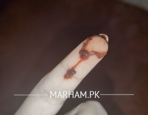 Irregular Menstruation