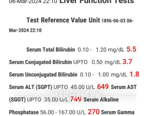 Jaundice Liver Problem 