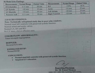 Pulse Rete Is Very High