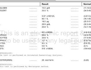 General Physician. High Platelets